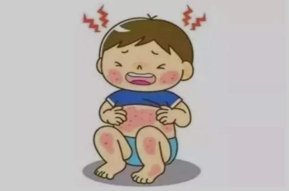 玫瑰疹发病症状有哪些?玫瑰疹发病有什么症状?