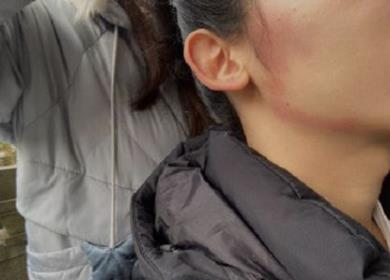 ic护肤攻略:用甲硝唑凝胶祛痘应对口罩脸过敏现象可行吗?